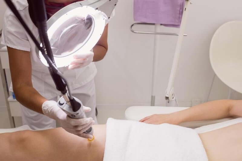 Laser Hair Removal
