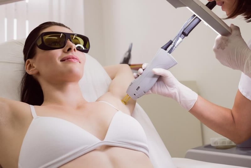 Laser Hair Removal