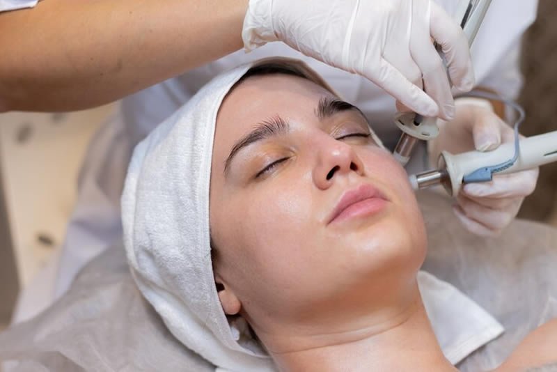 Microdermabrasion